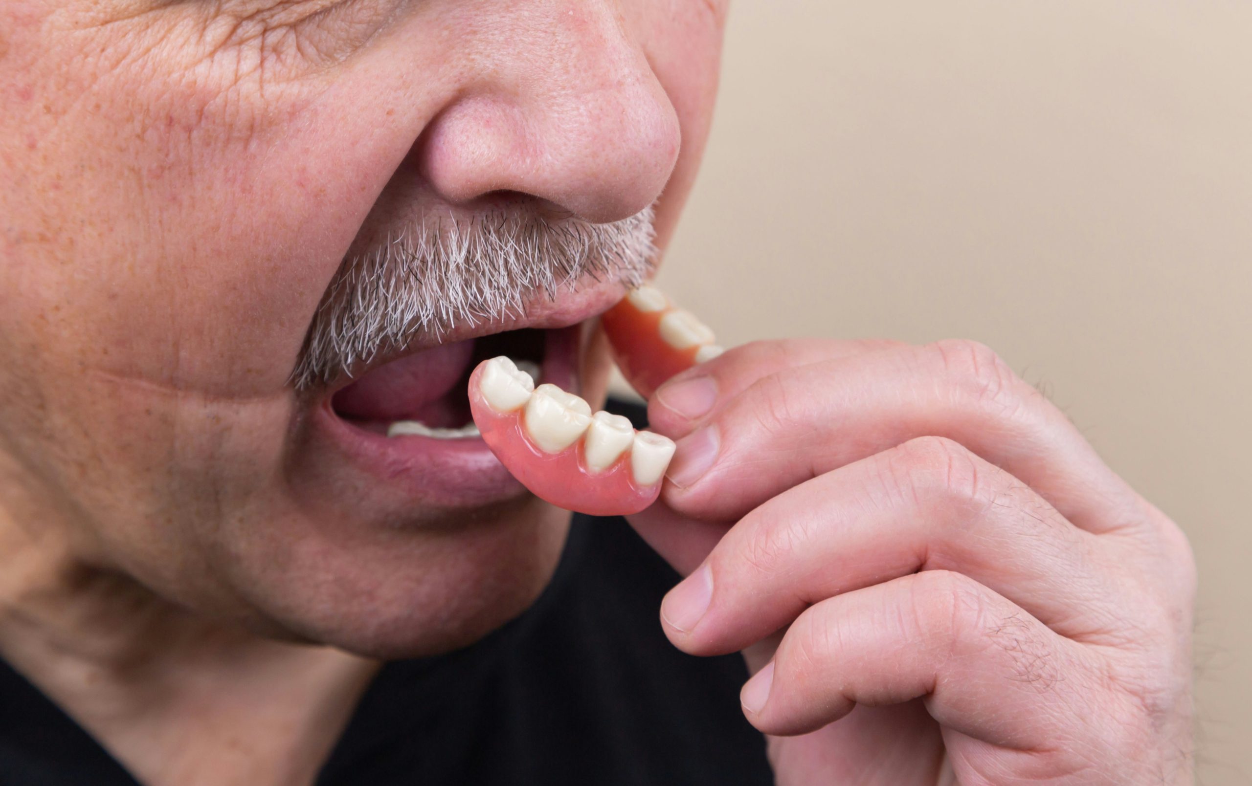 Understanding Dentures: Everything You Need to Know from Your Trusted Dentist in Eagle Grove, IA