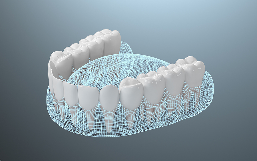 Experience the Future of Dentures with AvaDent® Digital Dentures in Eagle Grove, IA