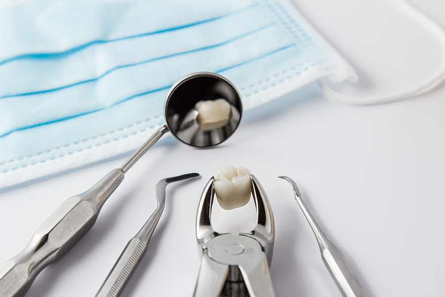 Understanding Tooth Extractions: What to Expect in Eagle Grove, IA